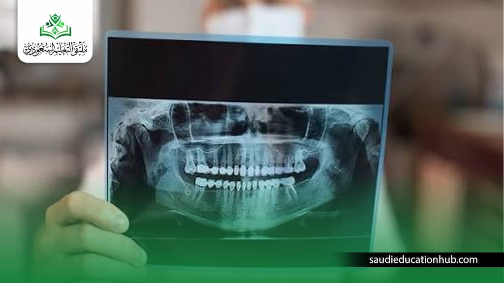دراسة ماجستير آشعة الفم في مصر