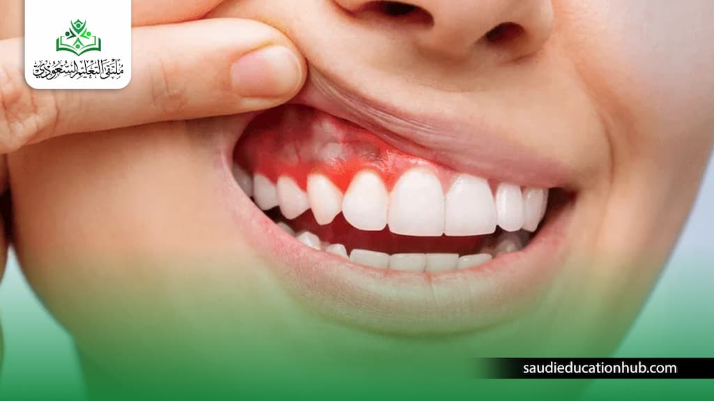ماجستير الفم وعلاج اللثة والتشخيص في مصر للوافدين والسعوديين ماجستير الفم وعلاج اللثة والتشخيص