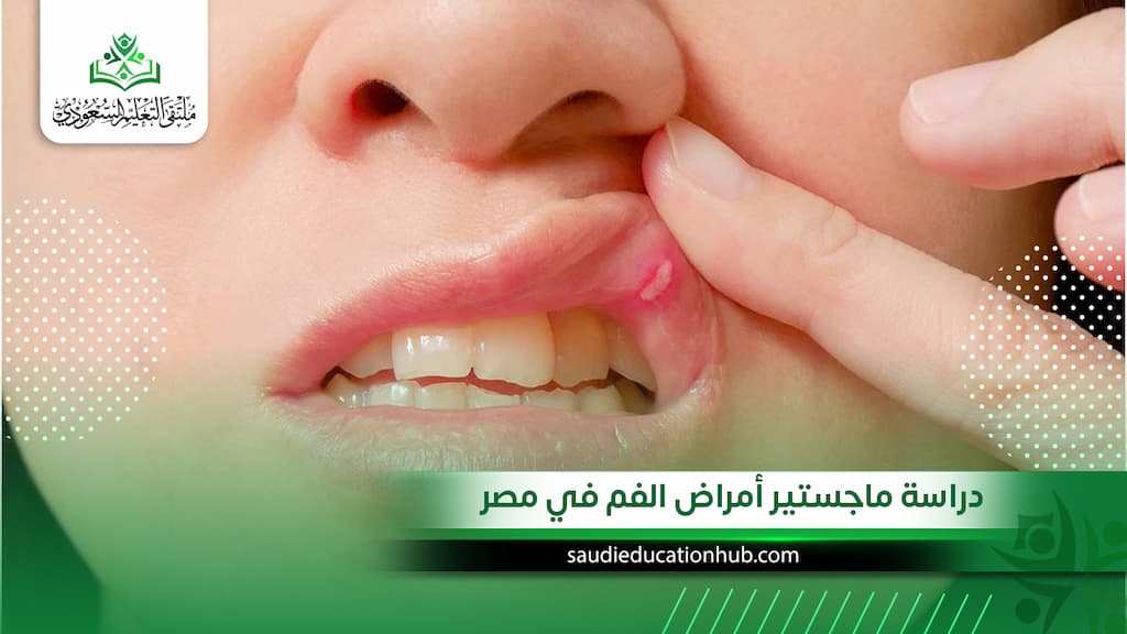 دراسة ماجستير أمراض الفم في مصر