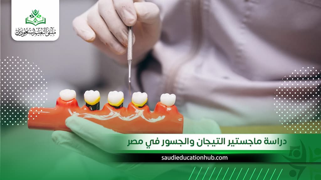دراسة ماجستير التيجان والجسور في مصر
