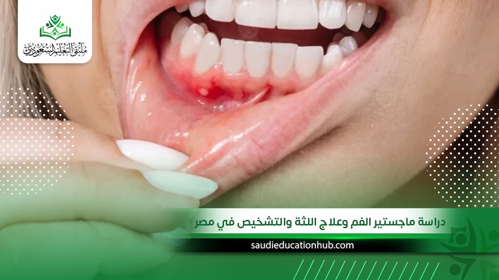 ماجستير الفم وعلاج اللثة والتشخيص في مصر للوافدين والسعوديين