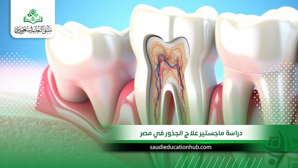 دراسة ماجستير علاج الجذور في مصر للوافدين والسعوديين